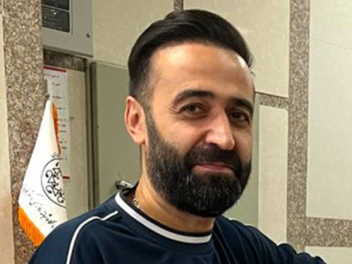 بعد از کاشت مو