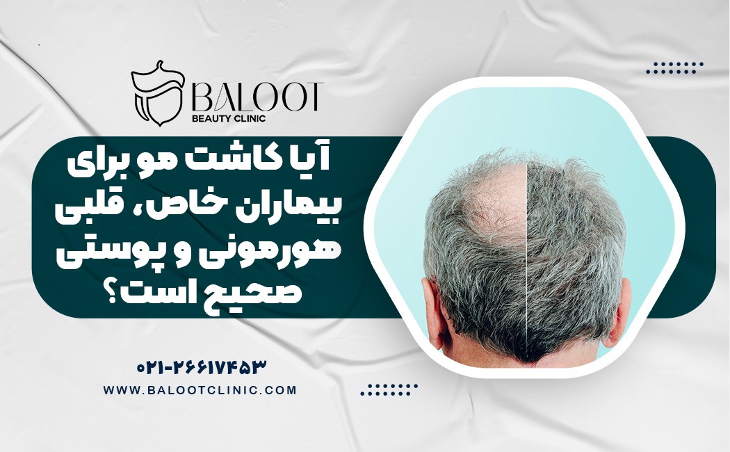 آیا کاشت مو برای بیماران خاص، قلبی، هورمونی و پوستی صحیح است؟