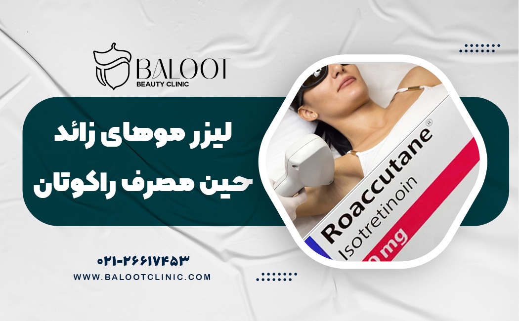 آیا لیزر موهای زائد حین مصرف راکوتان امکان پذیر است ؟