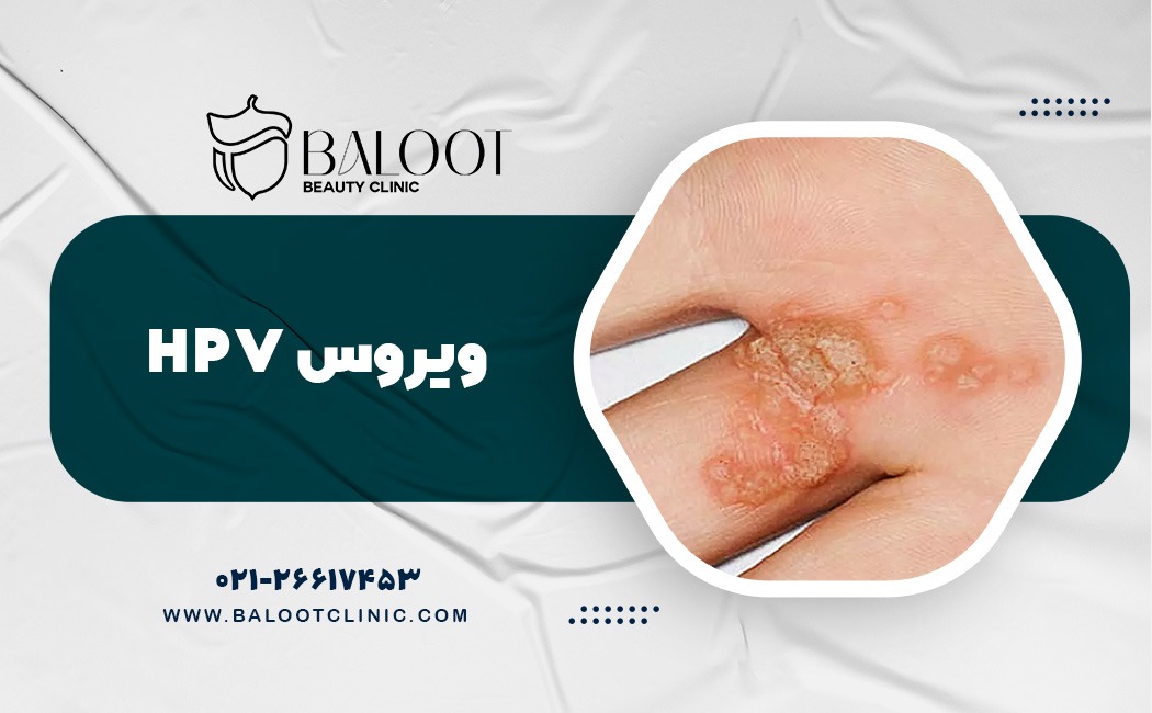 ویروس hpv چیست