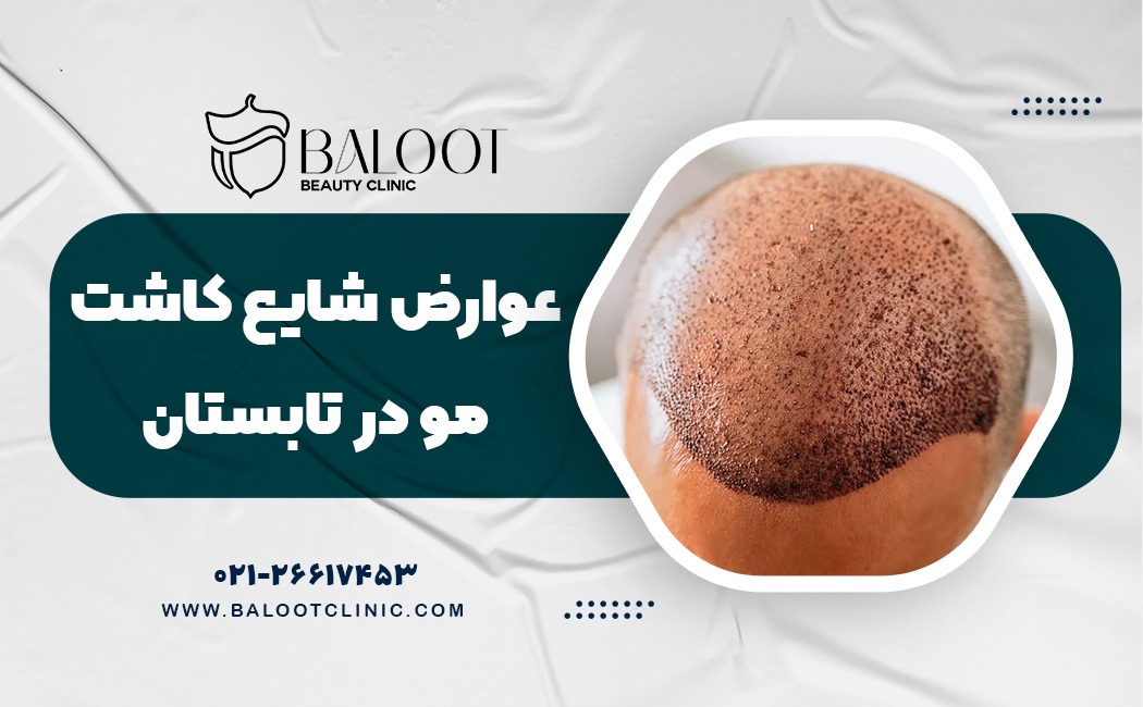 عوارض شایع کاشت مو در تابستان و روش‌های پیشگیری