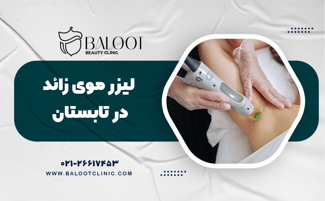 نکاتی که قبل از لیزر موی زائد در تابستان باید بدانید